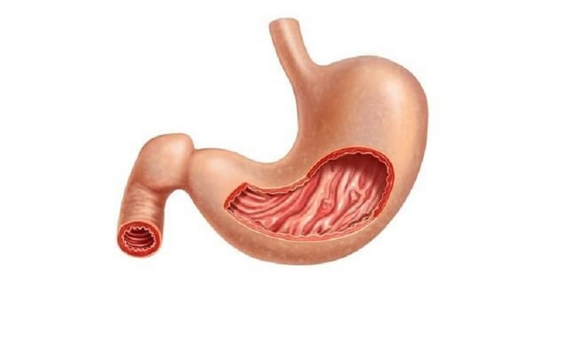 triệu chứng viêm teo niêm mạc dạ dày