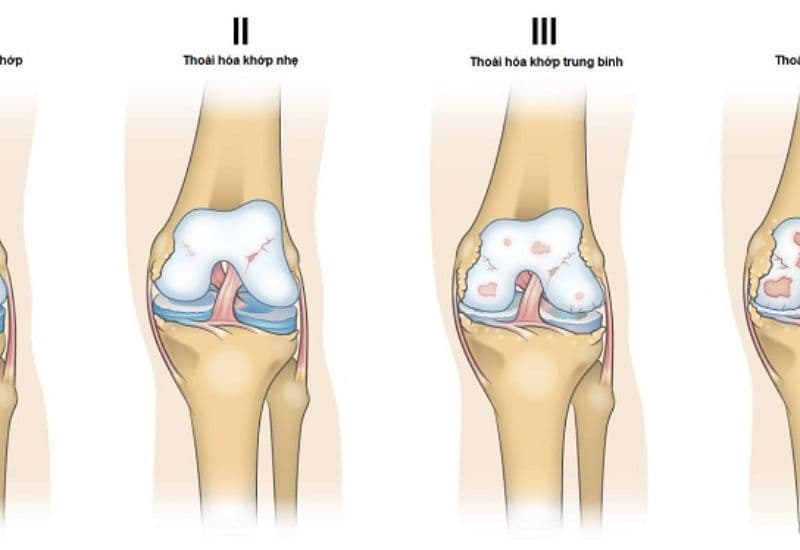 điện châm có tác dụng gì