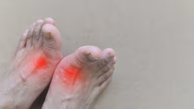 Bị gút có uống dầu cá được không?