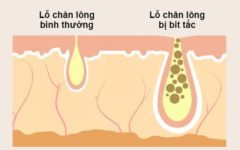 tác dụng của dầu oliu với da mặt