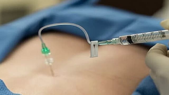 Các thuốc dùng để thủy châm giảm đau cơ xương khớp hiệu quả