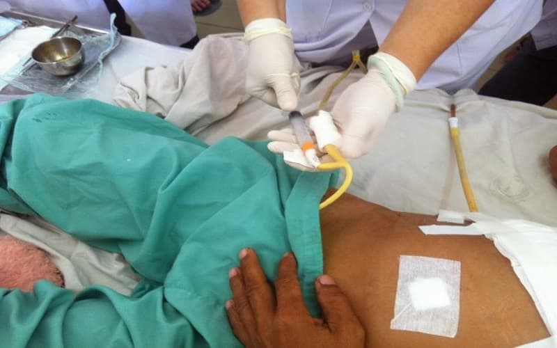 chống chỉ định đặt sonde tiểu