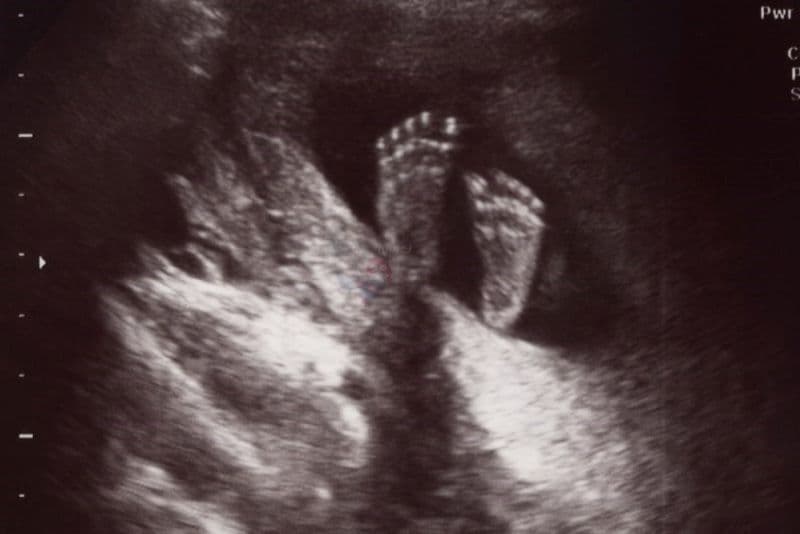 chiều dài bàn chân thai nhi theo tuần