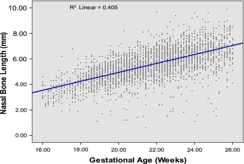 chiều dài xương mũi thai nhi 24 tuần 7mm