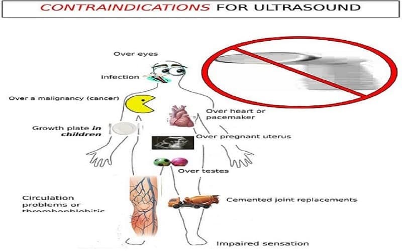 chống chỉ định của siêu âm trị liệu
