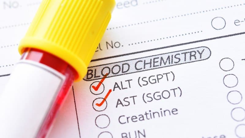 chống chỉ định ercp