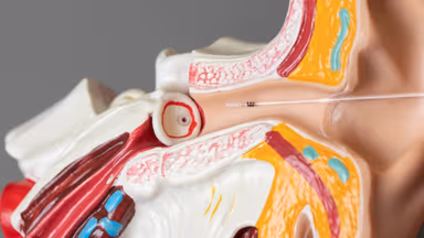 Đặt ống thông khí màng nhĩ có nguy hiểm không?