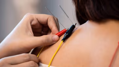 Điện châm chữa đau vai gáy có hiệu quả không và khi nào nên áp dụng?