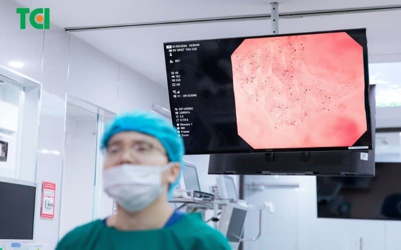 hình ảnh polyp đại tràng ác tính