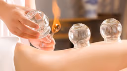 Giác hơi trị đau lưng có hiệu quả không và các lưu ý cần biết