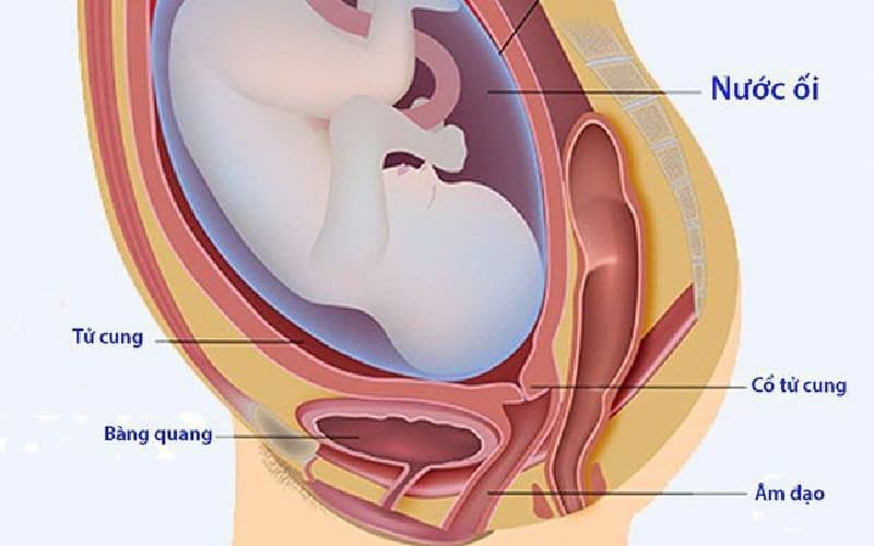 giãn bàng quang ở thai nhi