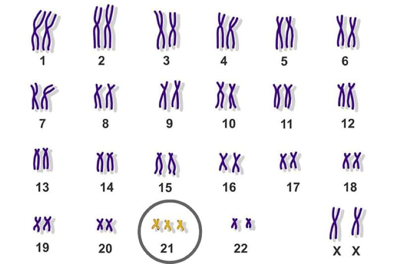 Gói xét nghiệm NIPT toàn diện tại Thu Cúc