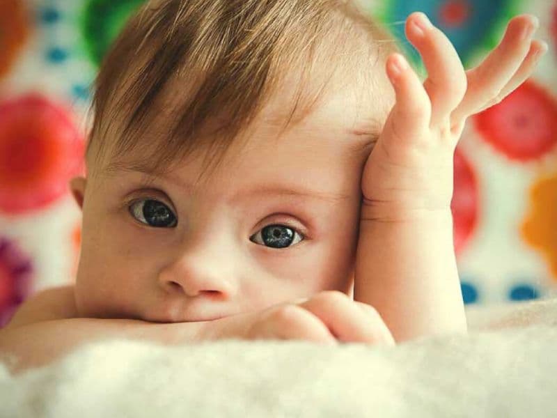 Mẹ bầu cần biết gì về hội chứng Down ở thai nhi?
