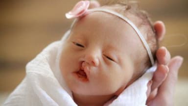 Hội chứng Edwards ảnh hưởng đến con như thế nào?