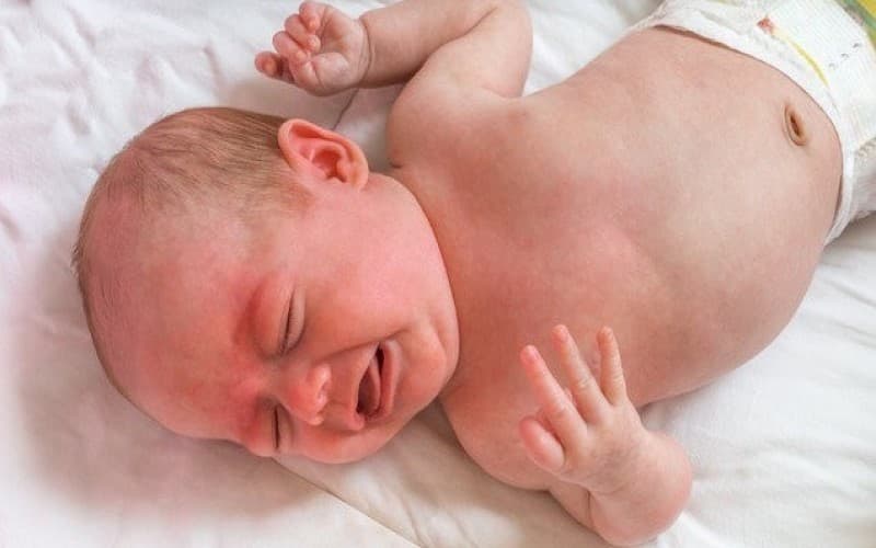 bất thường nhiễm sắc thể số 20