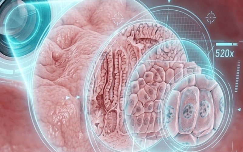 ung thư tiêu hóa có di truyền không