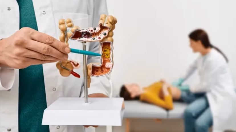 Phương pháp tầm soát ung thư đại tràng: Giải pháp phát hiện sớm và tăng cơ hội điều trị