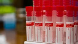 Tìm hiểu về marker ung thư tiền liệt tuyến