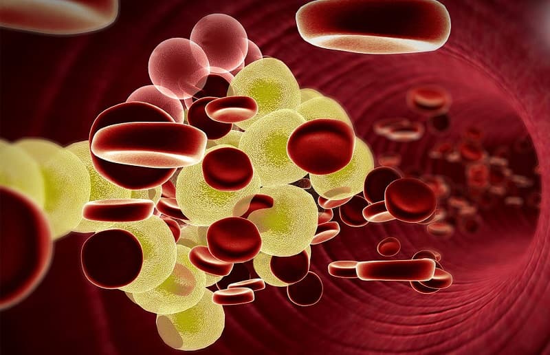 rối loạn lipid máu ở người cao tuổi