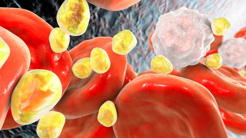 dấu hiệu có cục máu đông trong não