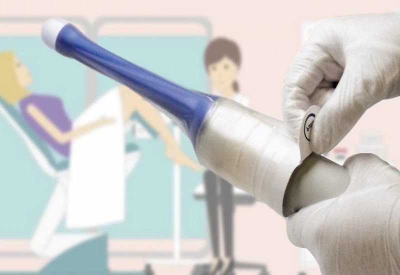 chống chỉ định siêu âm đầu dò