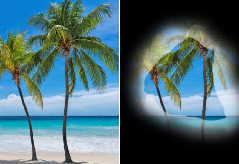 tăng nhãn áp góc đóng