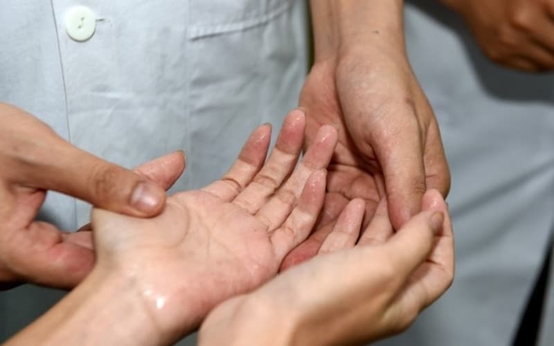 tăng tiết mồ hôi có nguy hiểm không