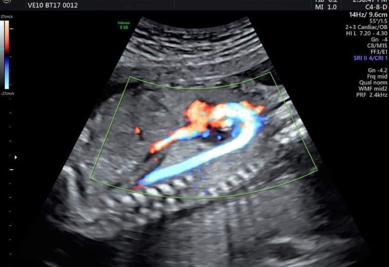 thai 8 tuần chiều dài đầu mông bao nhiêu