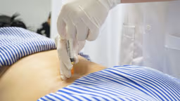 Thủy châm điều trị viêm khớp dạng thấp có hiệu quả không và những điều cần biết