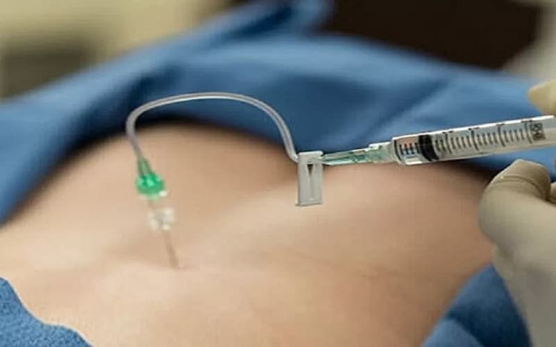 các thuốc dùng để thủy châm