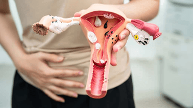 U nang buồng trứng siêu âm có thấy không? Cách chẩn đoán