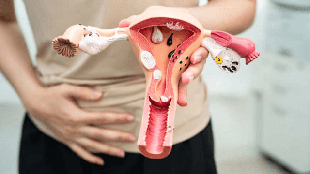 U nang buồng trứng siêu âm có thấy không? Cách chẩn đoán