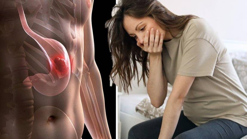 Ung thư dạ dày giai đoạn muộn: Vì sao dễ phát hiện trễ và cách phòng tránh