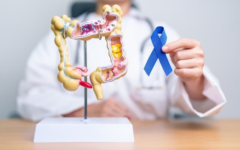 phương pháp tầm soát ung thư đại tràng