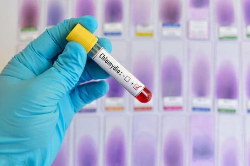 bệnh chlamydia lây qua đường nào