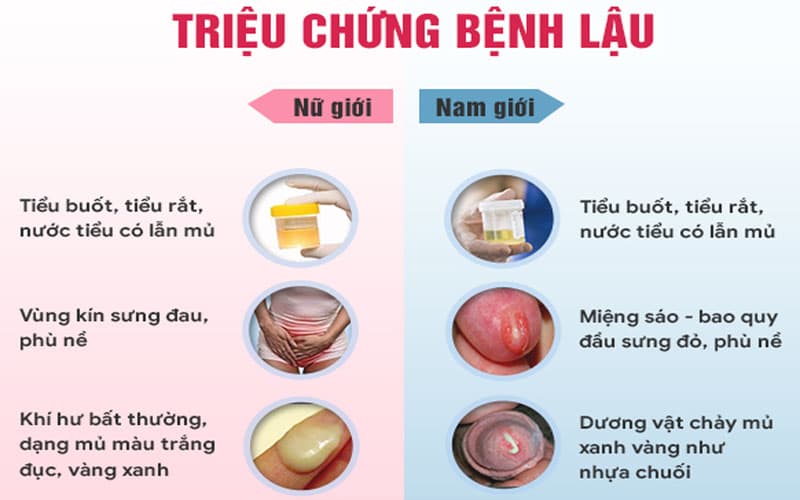 bệnh lậu bao nhiêu ngày thì phát bệnh