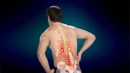 Chèn ép dây thần kinh ở lưng gây đau và cách cải thiện cần biết
