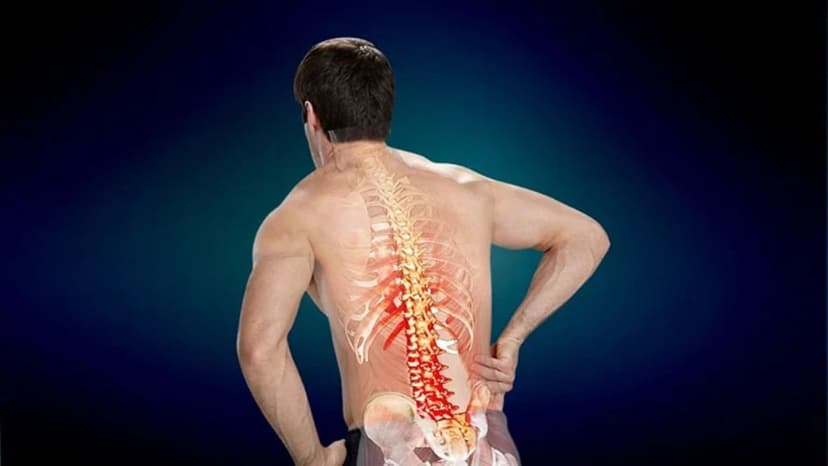 Chèn ép dây thần kinh ở lưng gây đau và cách cải thiện cần biết