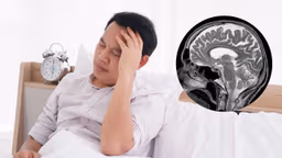 Khi nào cần chụp MRI não?