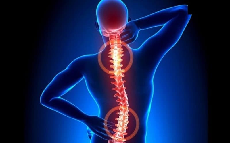 làm gì khi bị thoát vị đĩa đệm