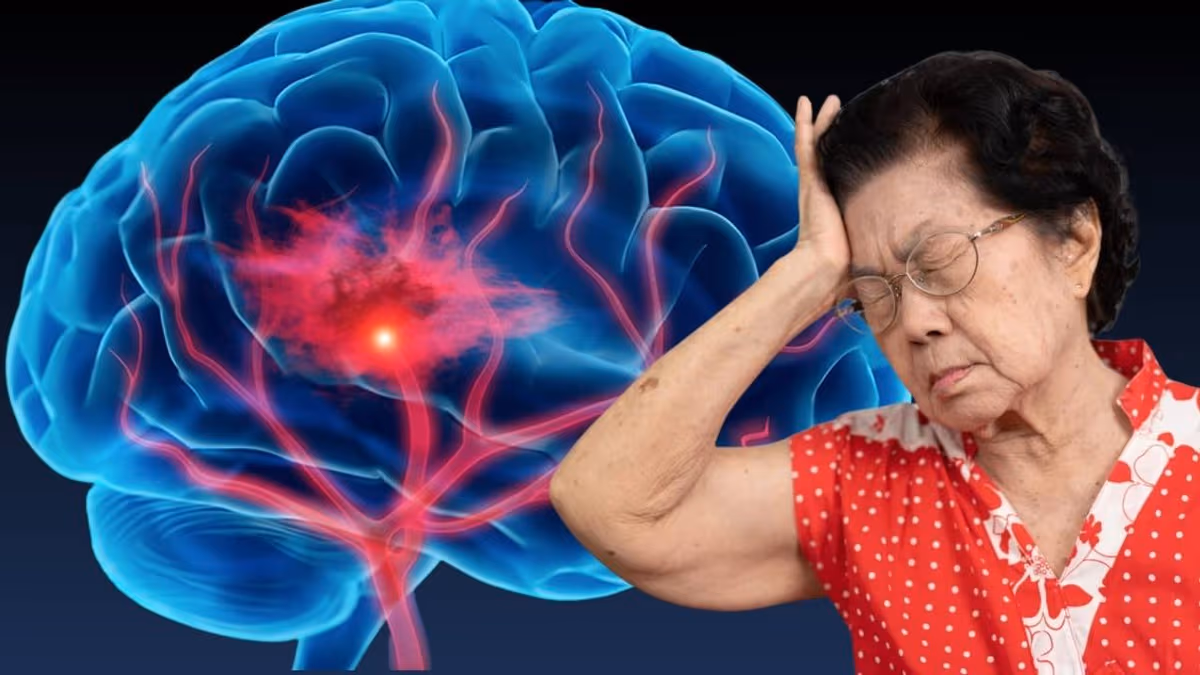 Khám sàng lọc đột quỵ cần khám những gì?