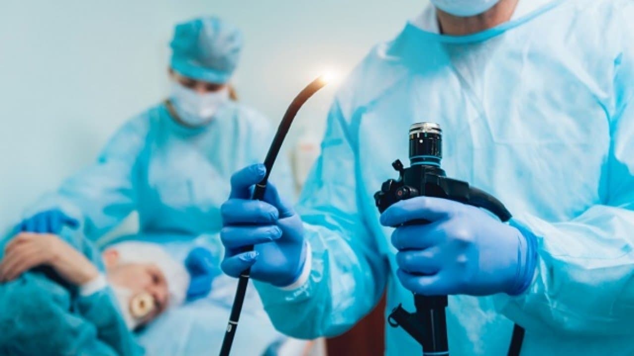 khi nào cần nội soi tiêu hóa