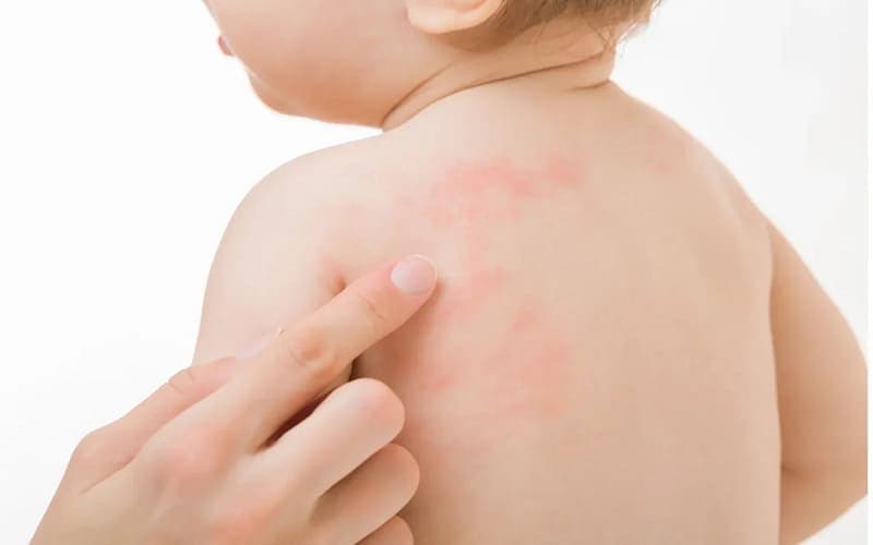 cách thử sữa cho trẻ dị ứng đạm bò