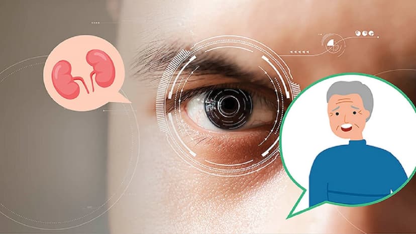 Mắt của người suy thận có gì cần chú ý?