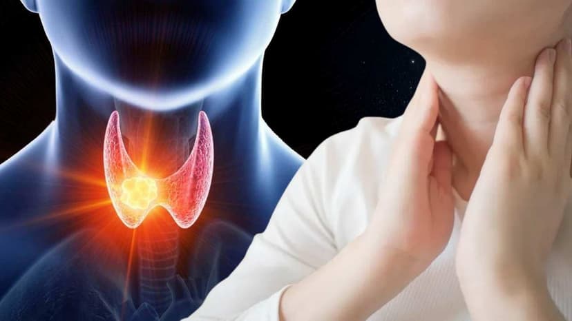 Nang tuyến giáp kích thước bao nhiêu phải mổ?
