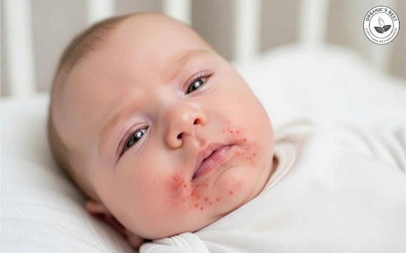 cách thử sữa cho trẻ dị ứng đạm bò