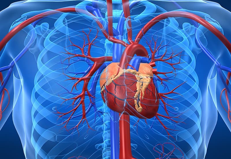 tiêu chuẩn chẩn đoán nhồi máu cơ tim