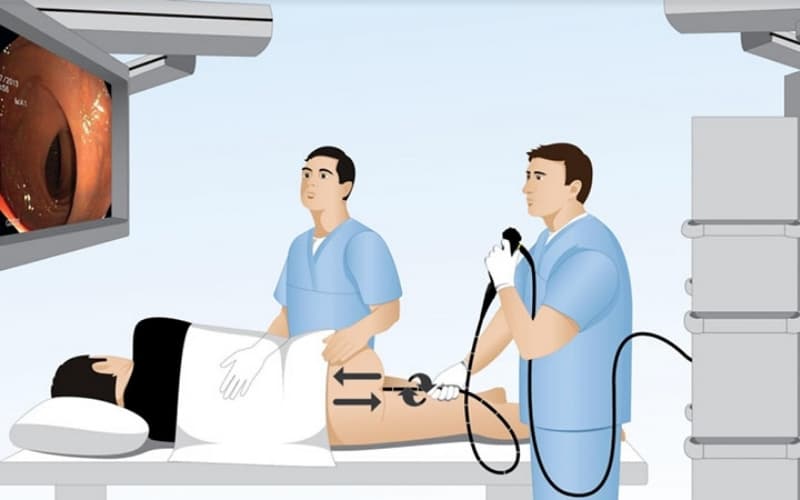 nội soi tiêu hóa gồm những gì