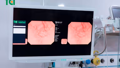 Nội soi thực quản dạ dày phóng đại và vai trò trong phát hiện sớm ung thư tiêu hóa