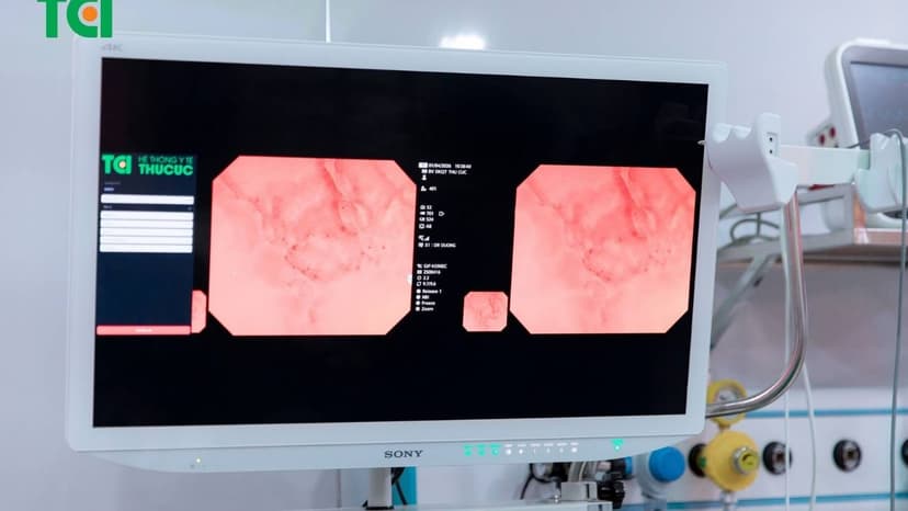 Nội soi thực quản dạ dày phóng đại và vai trò trong phát hiện sớm ung thư tiêu hóa